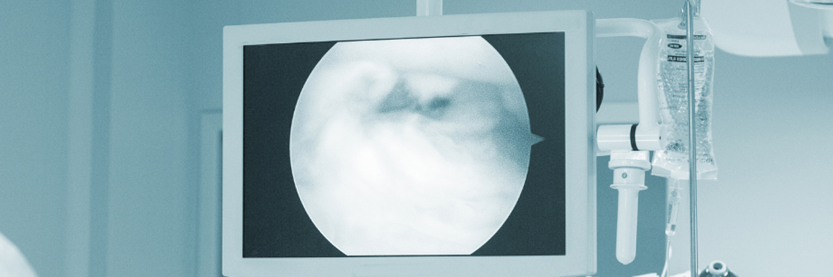 Bariatric & Weight Loss Surgery
