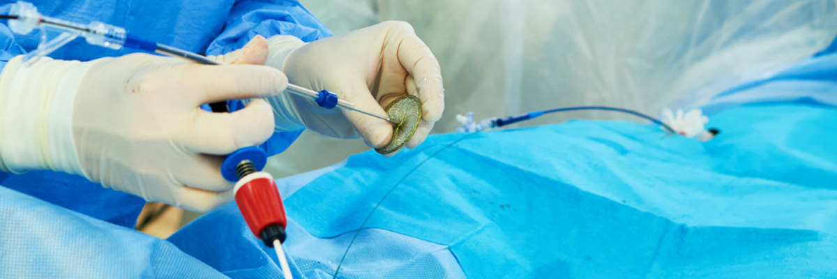 Vascular Surgery