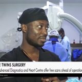 Euracare provides free scans to Siamese twins conjoined at the head