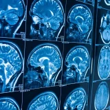 International Day of Radiology 2021