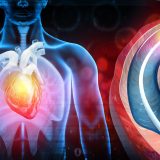 Interventional Cardiology