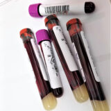 How Health Screenings Tests Keep The Body At Optimal Function