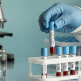 Understanding Essential Health Screenings